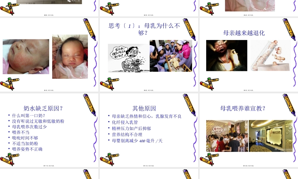 儿童过敏病例分享.pptx