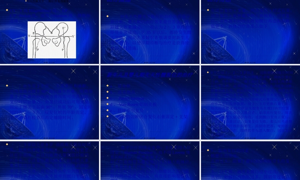 先天性髋关节脱位.pptx