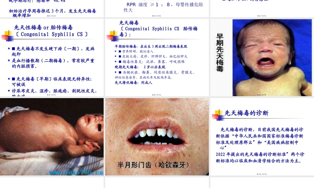 先天性梅毒.pptx