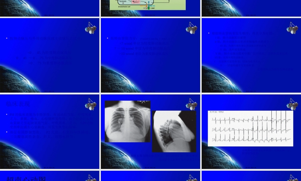 先心病与肺动脉高压.pptx