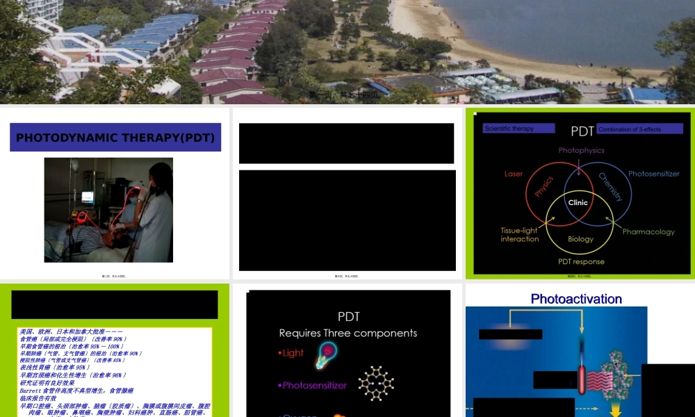 光动力疗法根治早期癌有潜力-徐克成.pptx