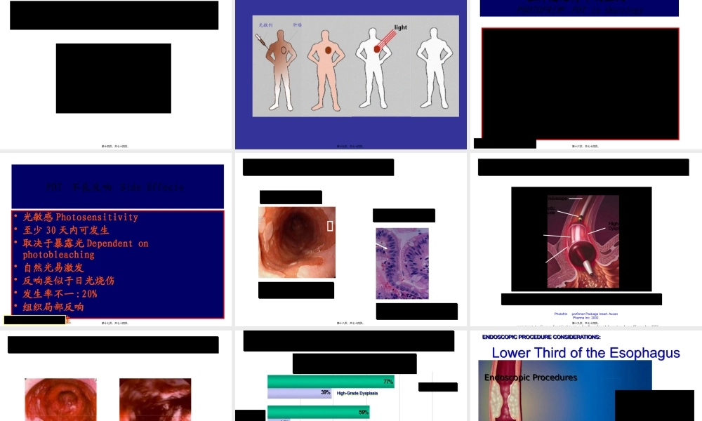 光动力疗法根治早期癌有潜力-徐克成.pptx