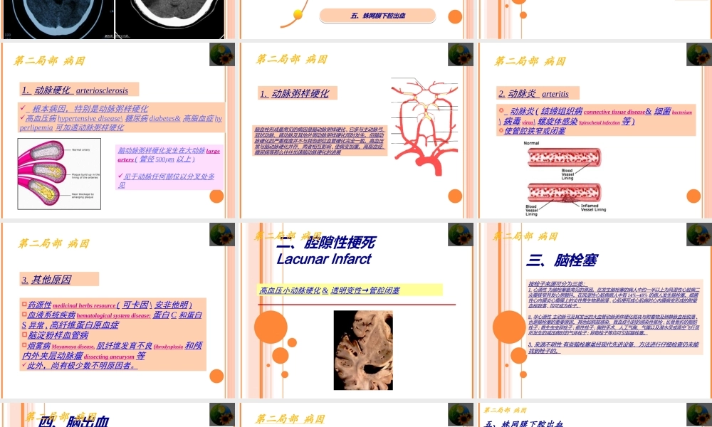 全面认识脑卒中.ppt