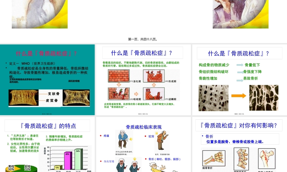 关节痛之骨质疏松.pptx