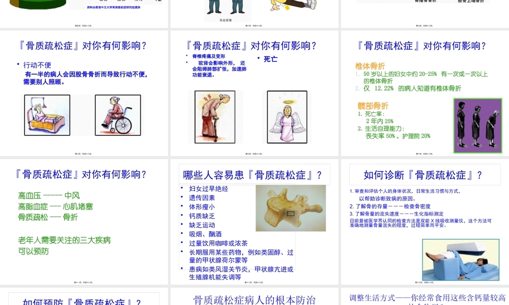 关节痛之骨质疏松.pptx