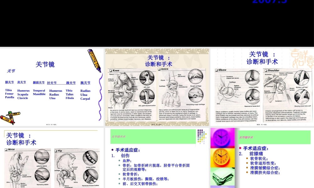 关节镜手术.pptx