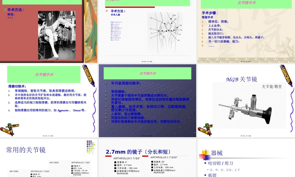 关节镜手术.pptx
