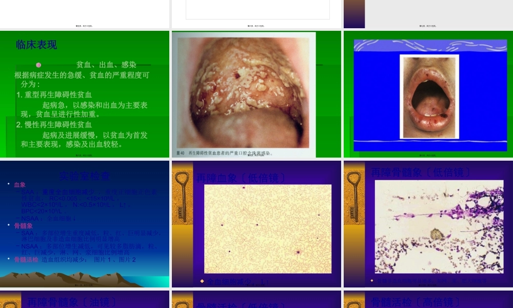 再生障碍性贫血(新).pptx