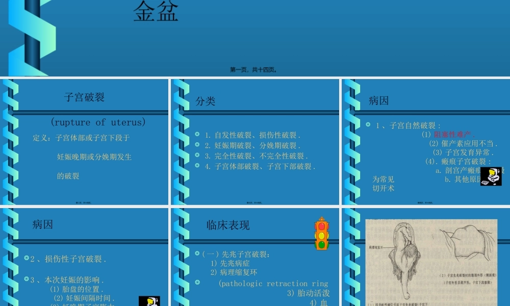 分娩期并发症子宫破裂实习.pptx