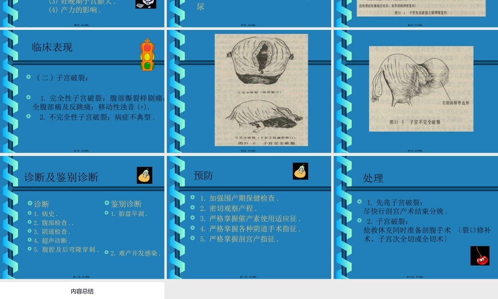 分娩期并发症子宫破裂实习.pptx