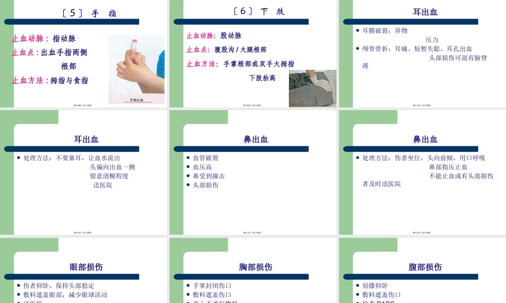 创伤急救——止血、包扎.pptx