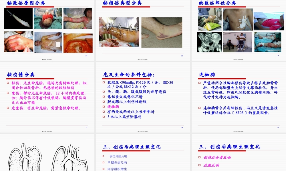 创伤概述多发伤复合伤.pptx