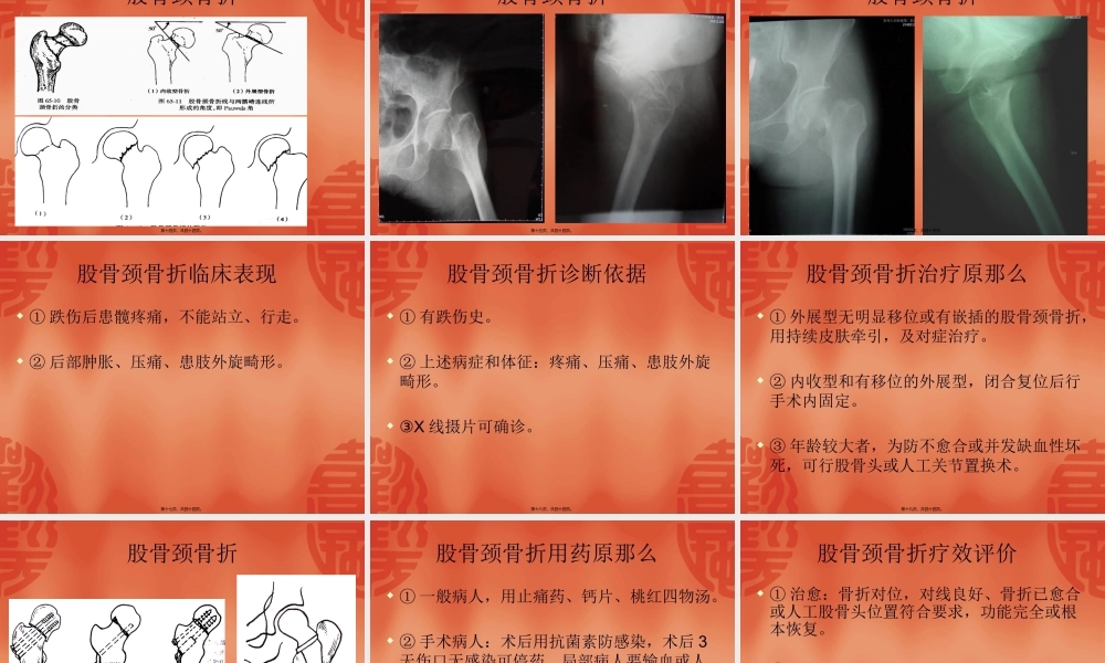 利于骨痂形成促进骨折愈合.pptx