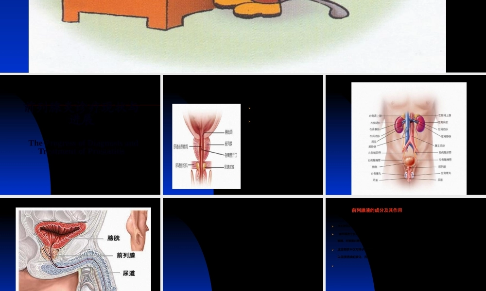 前列腺炎诊疗现状与进展.ppt