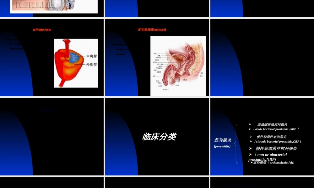 前列腺炎诊疗现状与进展.ppt