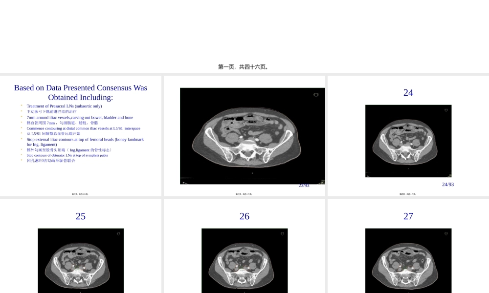 前列腺癌淋巴结及靶区勾画.pptx