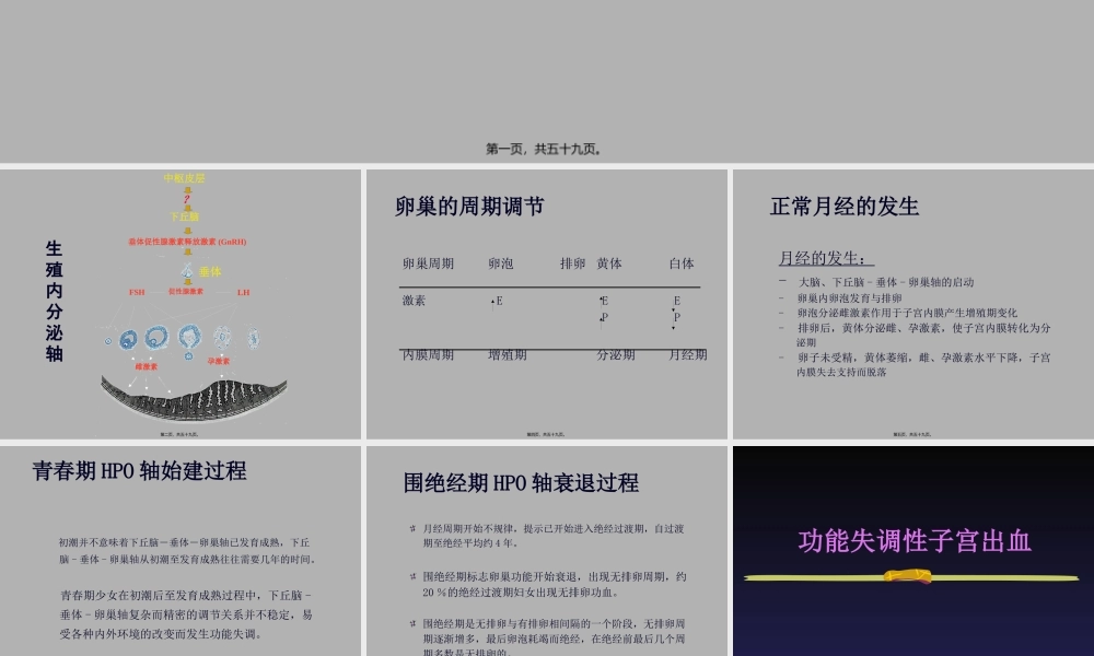 功能失调性子宫出血.pptx