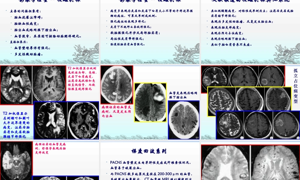 原发性中枢神经系统血管炎.pptx