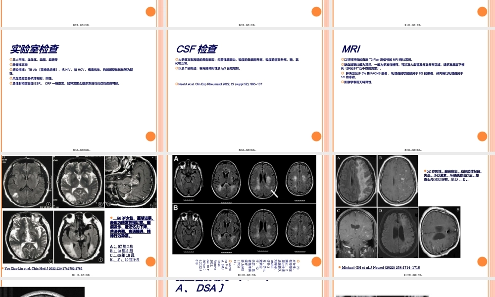 原发性中枢神经系统血管炎.ppt