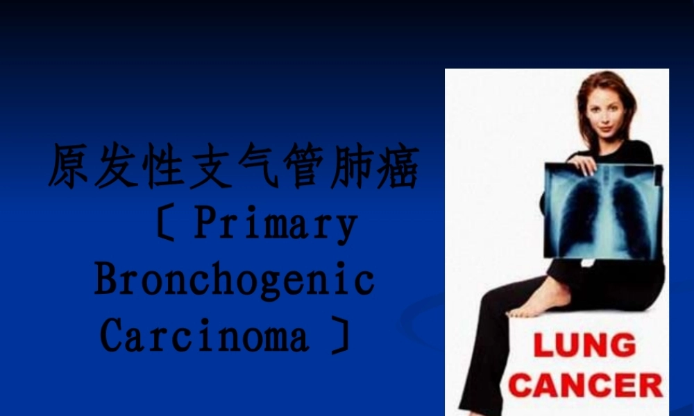 原发性支气管肺癌概述.pptx