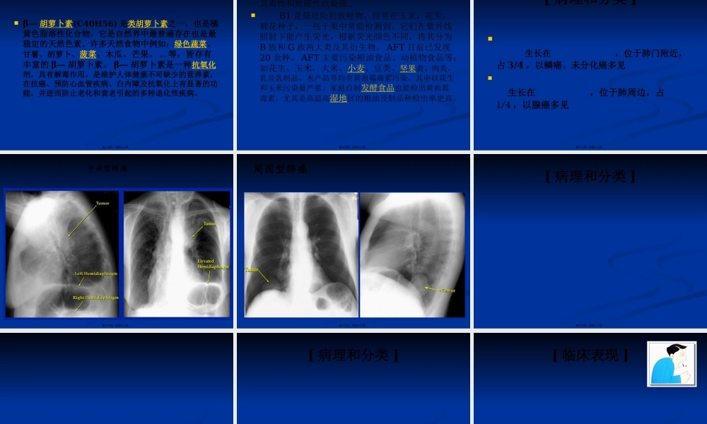 原发性支气管肺癌概述.pptx