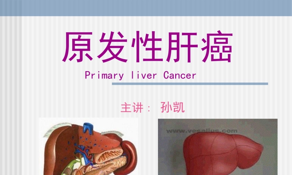 原发性肝癌.ppt
