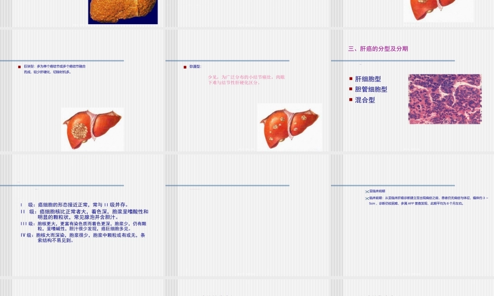 原发性肝癌.ppt