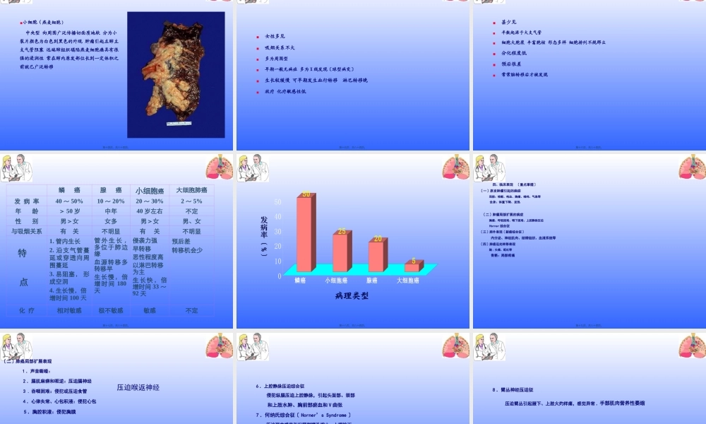 原发性支气管肺癌.ppt