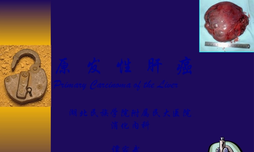 原发性肝癌-人卫8版by-tjw.ppt