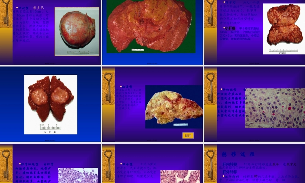 原发性肝癌-人卫8版by-tjw.ppt