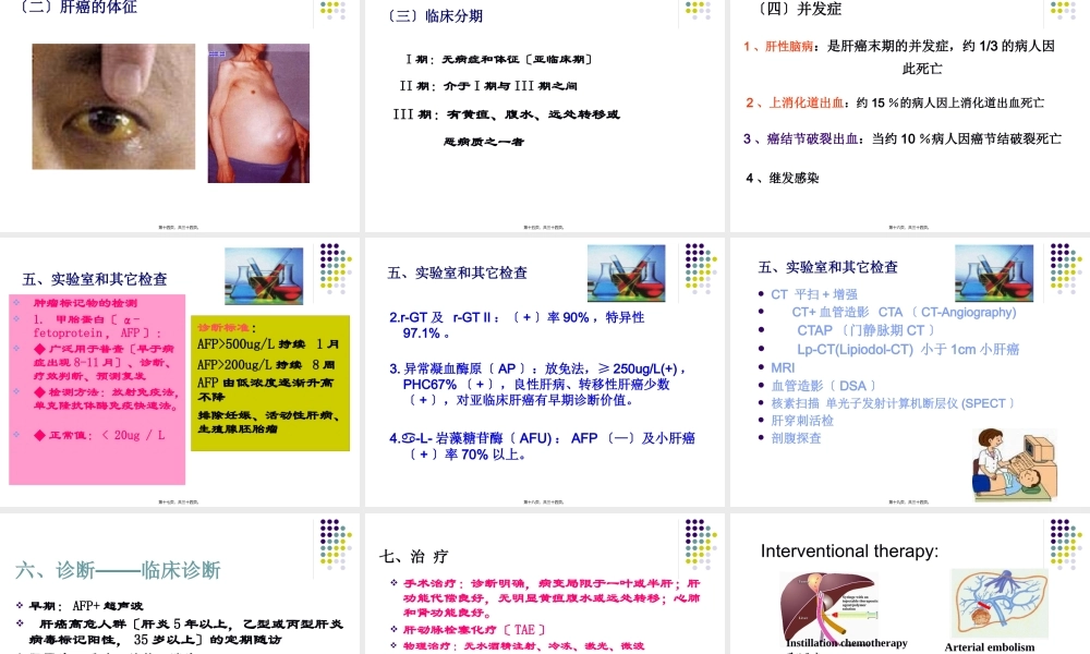 原发性肝癌讲解.pptx