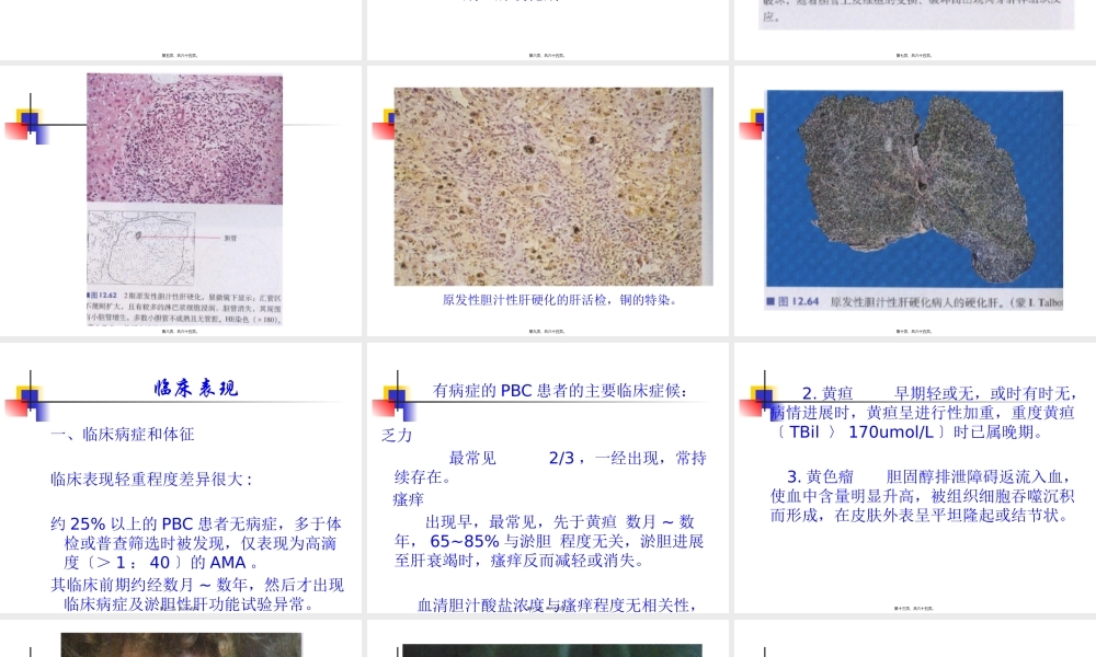 原发性胆汁性肝硬化和原发性硬化性胆管炎的诊治现状.pptx