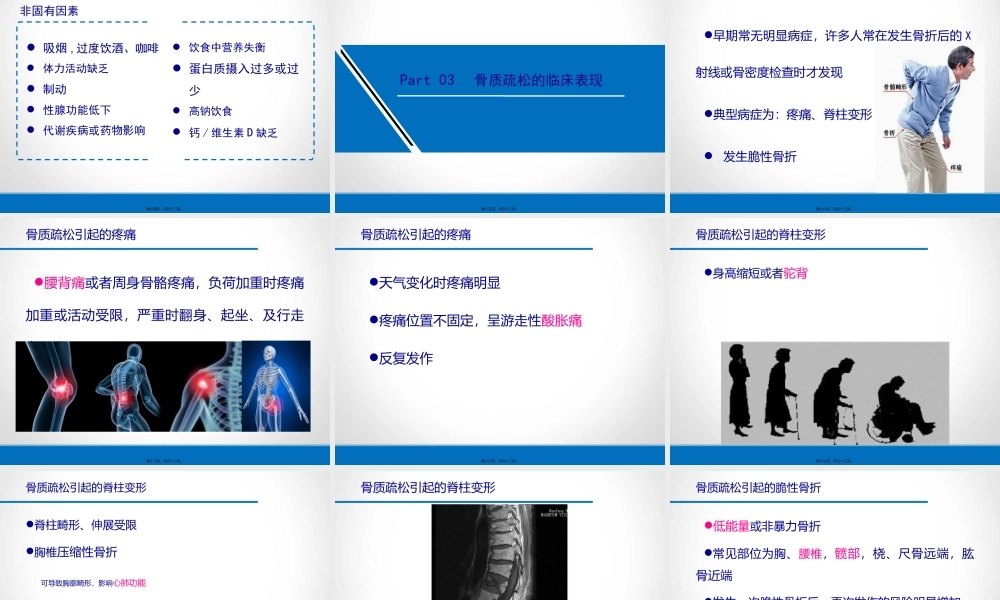 原发性骨质疏松症.ppt