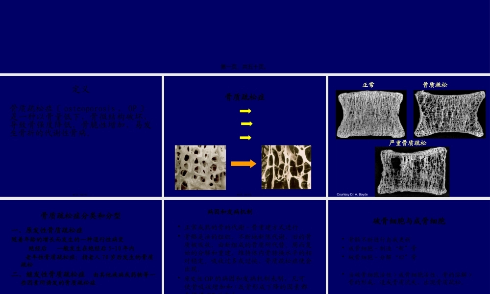 原发性骨质疏松症.pptx