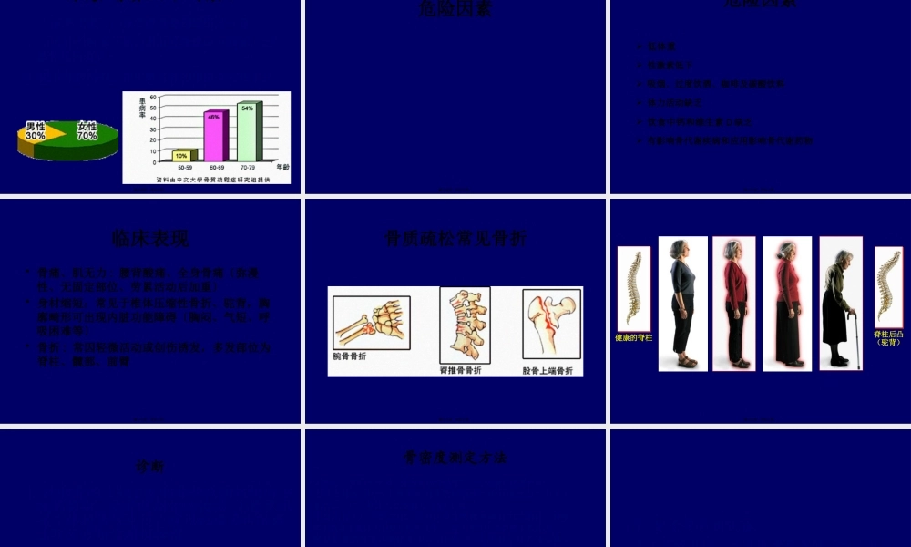 原发性骨质疏松症.pptx