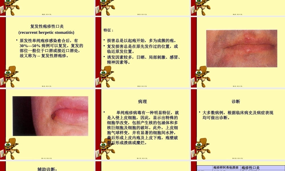 口腔单纯疱疹.pptx