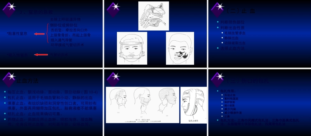 口腔颌面部损伤.pptx