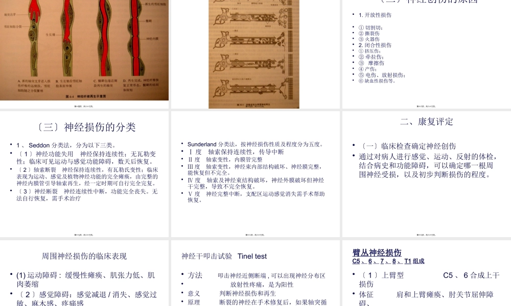 周围神经伤病后的.pptx