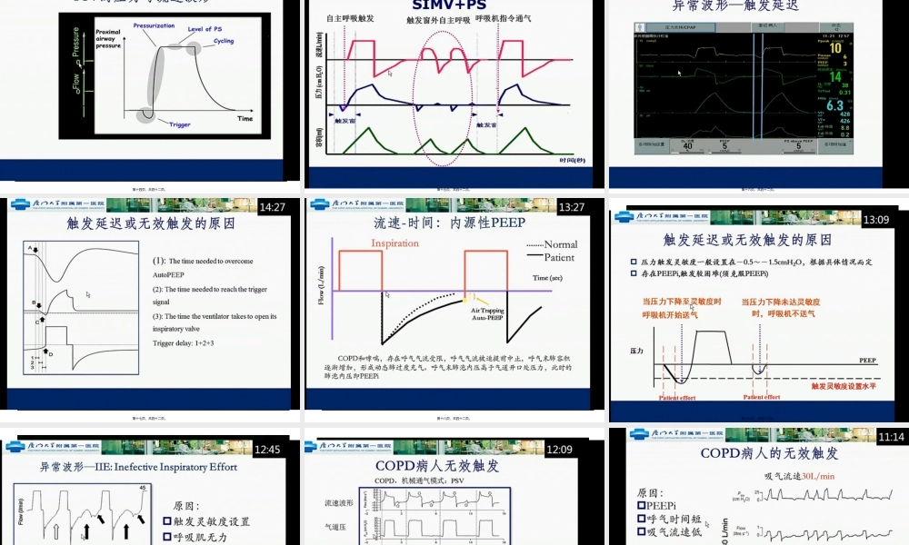 呼吸机支持波形.pptx