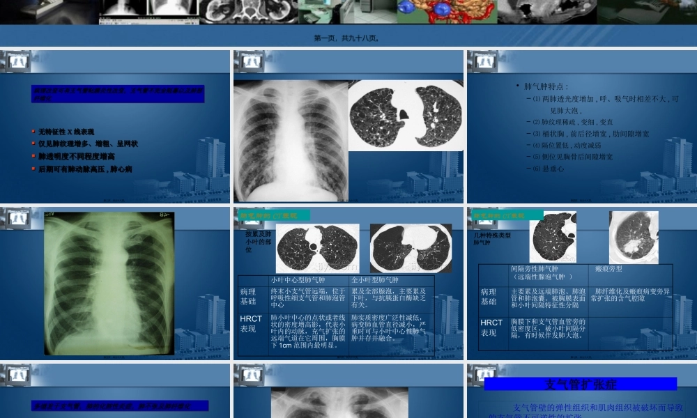 呼吸系统影像学.pptx