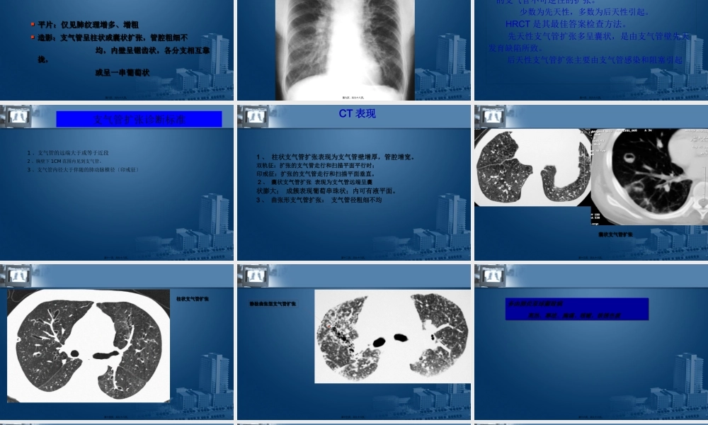 呼吸系统影像学.pptx