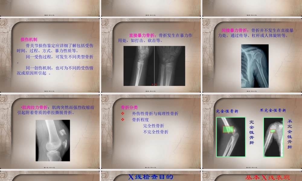 四肢骨关节损伤.ppt