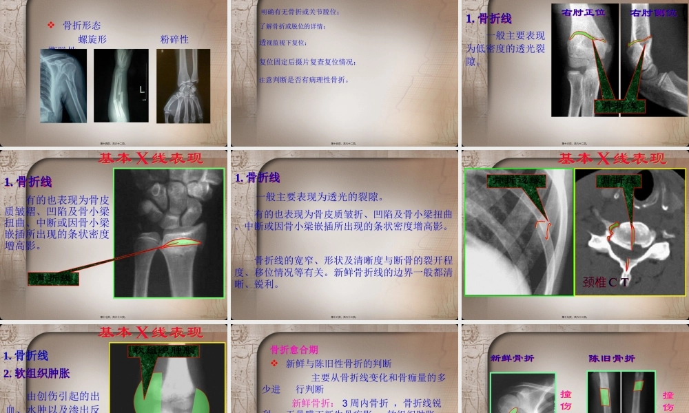 四肢骨关节损伤.ppt