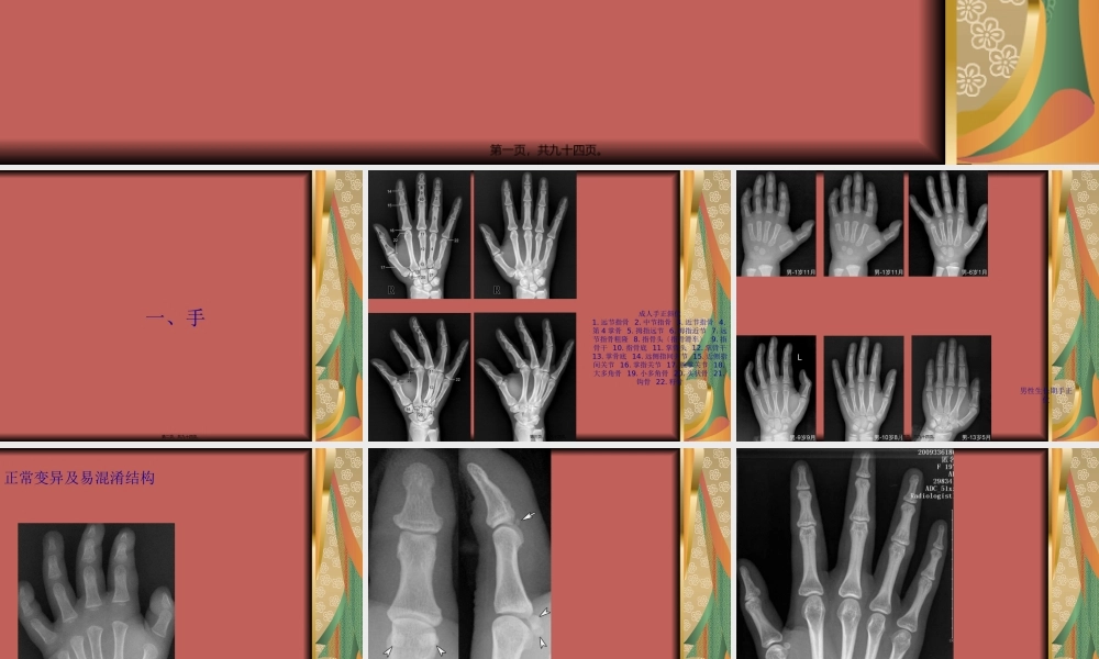 四肢关节正常变异、常见病变及创伤的影像表现.pptx