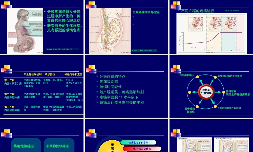 国内外分娩镇痛现状.pptx