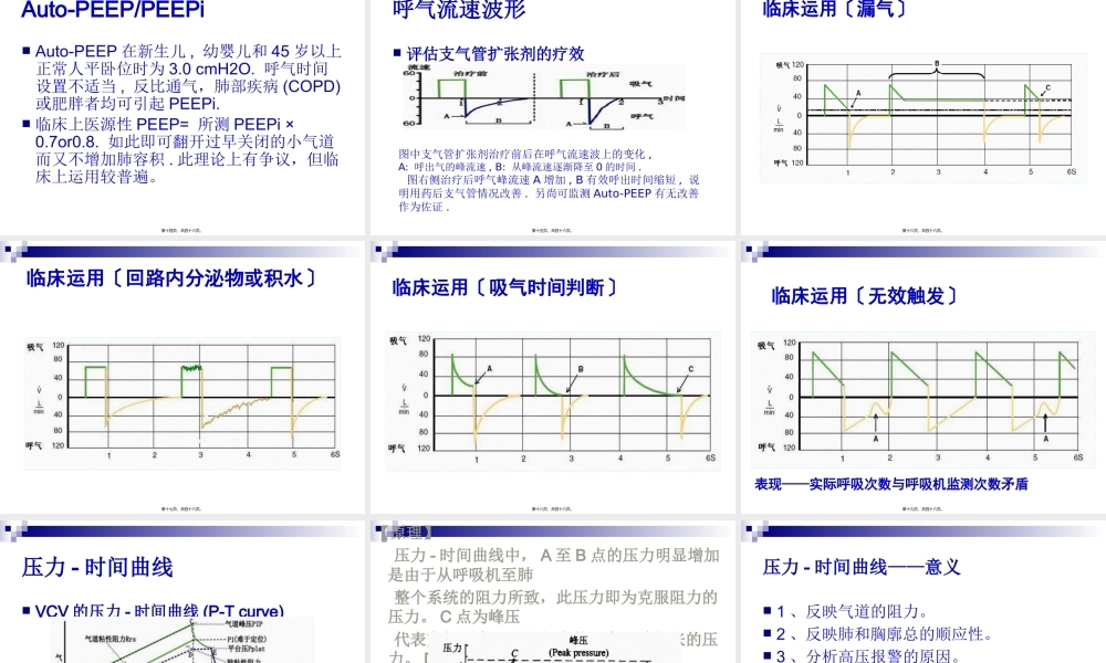 基础呼吸机波形分析、SIMV模式-丁广湘.pptx