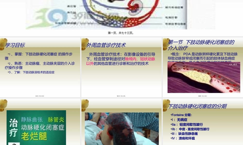 外周血管系统-(2).ppt