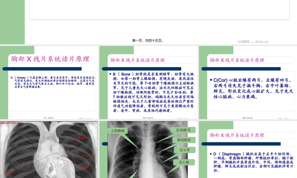 外科胸部X线片系统读片方法.pptx