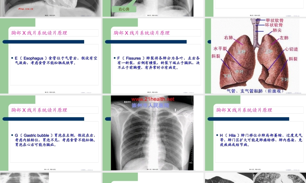 外科胸部X线片系统读片方法.pptx