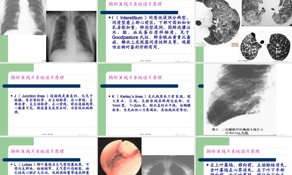 外科胸部X线片系统读片方法.pptx